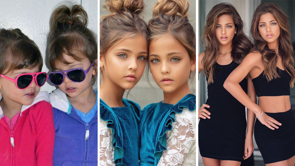 Wait Until You See The Most Beautiful Twins In The World Now